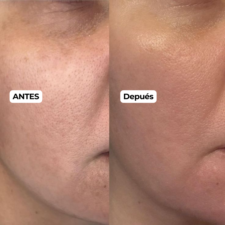 KIT DOBLE LIMPIEZA - Anua